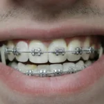 Real-Smile-Stories2 2