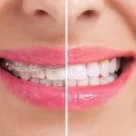 Real-Smile-Stories3 1
